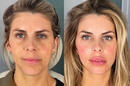 أفضل 8 نقاط تجميل في دبي وأبو ظبي