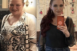 تكلفة حقن مونجارو دبي وأبو ظبي