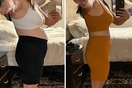 تكلفة حقن مونجارو في دبي بالإمارات العربية المتحدة