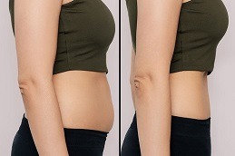 حقن ويجوفي دبي الإمارات العربية المتحدة