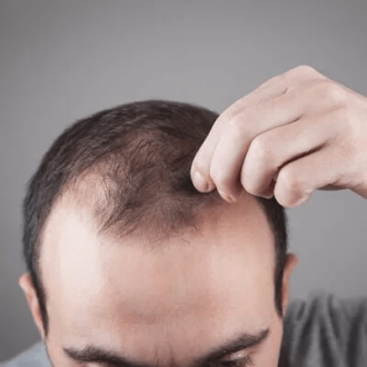 تكلفة زراعة الشعر بالقرب مني – دليل الأسعار في دبي