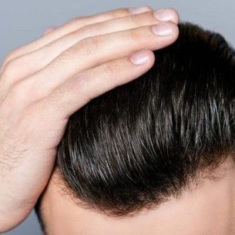 تكلفة زراعة الشعر في دبي