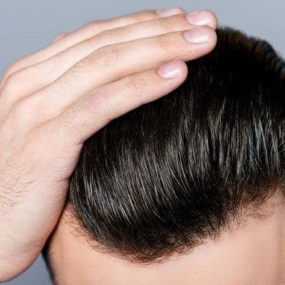 تكلفة زراعة الشعر في دبي