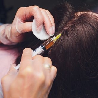 الحقن بالبلازما (PRP) مقابل خلايا النمو المركزة (GFC): ما الأفضل لعلاج تساقط الشعر في دبي؟