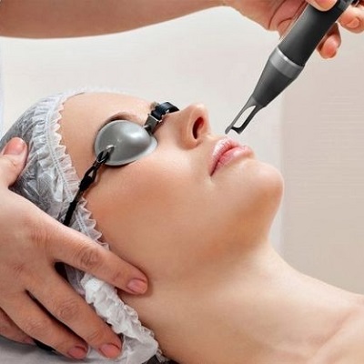 Face Laser Treatments Cost in Dubai