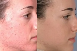 Skin rashes Treatment – Soothing Skin Care – Estheticare Dubai