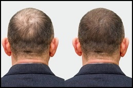 Best Trichologists Clinic in Dubai & Abu Dhabi