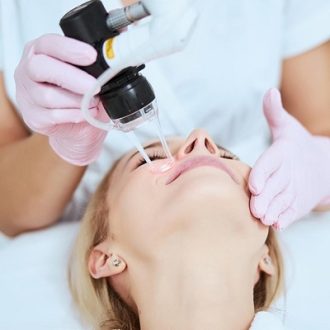 Fractional CO2 Laser Treatment Cost in Dubai