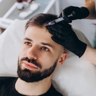 PRP and PRF Hair Restoration in Dubai