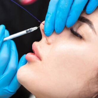 Hiko Nose Thread Lift Dubai UAE