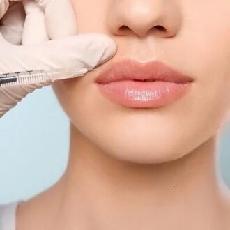 Does Botox lip flip change your smile?