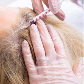How Much Does Hair Restoration Typically Cost?